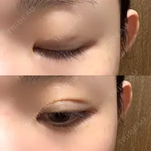 湘南美容クリニック 湘南美容クリニック 新宿本院口コミ