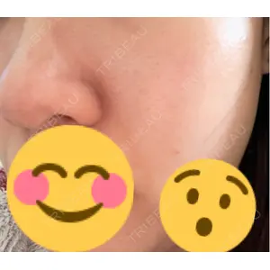 ミニマムスキンクリニック ミニマムスキンクリニック池袋口コミ