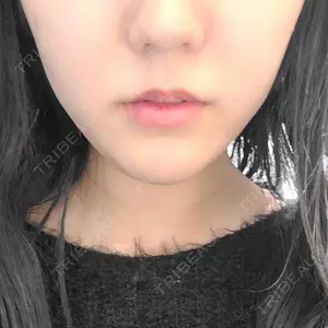 口コミ