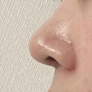 セギム美容整形外科口コミ