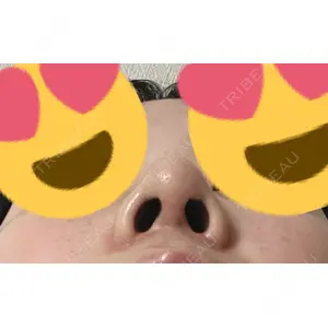 セギム美容整形外科口コミ