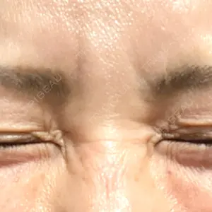 TCB東京中央美容外科 神戸院の