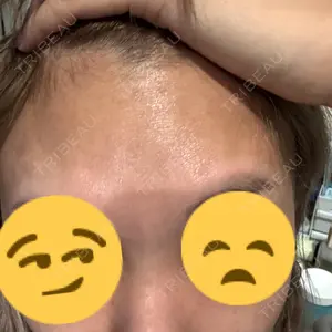 TCB東京中央美容外科 TCB東京中央美容外科 池袋駅前院口コミ