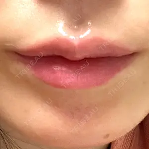 APスキンクリニック銀座口コミ