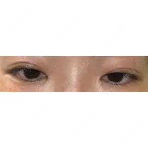 口コミ