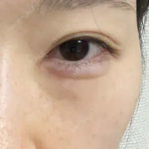 口コミ