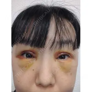 東京シンデレラ美容外科 東京シンデレラ美容外科 池袋院口コミ