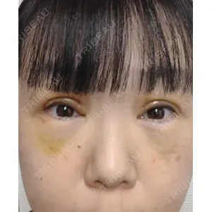 東京シンデレラ美容外科 東京シンデレラ美容外科 池袋院口コミ