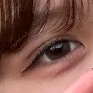 ルラ美容クリニック ルラ美容クリニック 渋谷本院口コミ