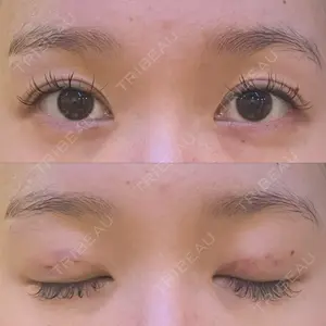 渋谷の森クリニック口コミ