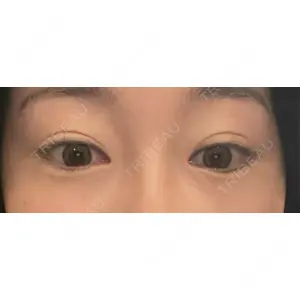東京シンデレラ美容外科 東京シンデレラ美容外科 池袋院口コミ