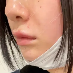 ルラ美容クリニック ルラ美容クリニック 高田馬場院口コミ