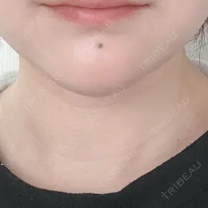 フォンタナクリニック天神口コミ