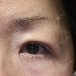 湘南美容クリニック 湘南美容クリニック 千葉センシティ院口コミ