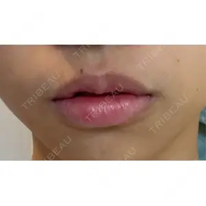 R Beauty CLINIC R Beauty CLINIC 銀座院口コミ