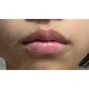 R Beauty CLINIC R Beauty CLINIC 銀座院口コミ