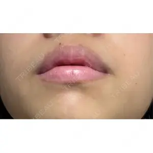 R Beauty CLINIC R Beauty CLINIC 銀座院口コミ