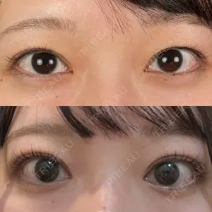 YBC横浜美容外科 大宮院口コミ