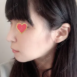 RG整形外科（旧リオン整形外科）口コミ