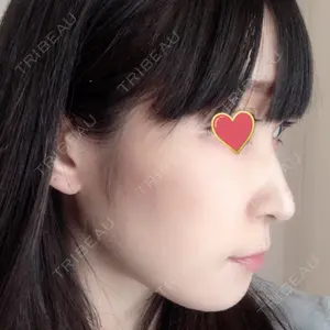 RG整形外科（旧リオン整形外科）口コミ