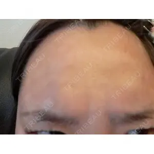 TCB東京中央美容外科 TCB東京中央美容外科 池袋駅前院口コミ