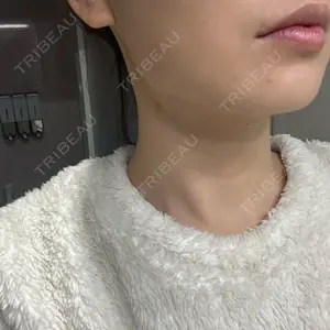 ルラ美容クリニック ルラ美容クリニック 大阪本院口コミ