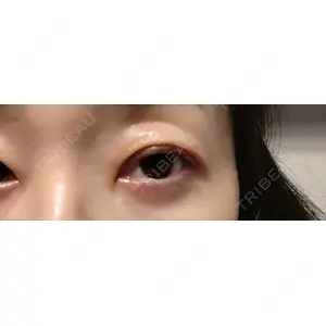 口コミ
