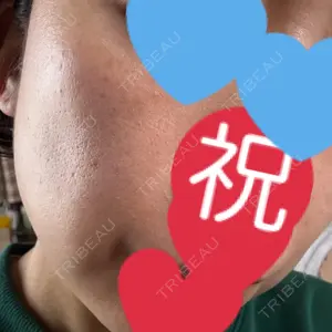 ミニマムスキンクリニック ミニマムスキンクリニック池袋口コミ