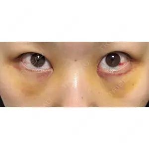 藤・ナチュレ美容クリニック 藤・ナチュレ美容クリニック 銀座院口コミ