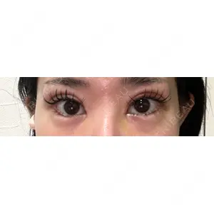 東京シンデレラ美容外科 東京シンデレラ美容外科 池袋院口コミ