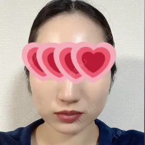 口コミ
