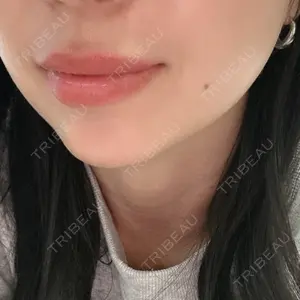 口コミ