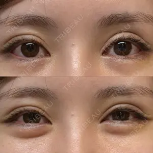 AI Beauty Clinic （エーアイ美容クリニック）口コミ