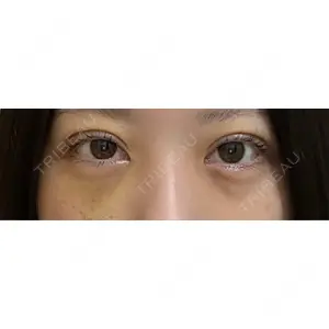 東京シンデレラ美容外科 東京シンデレラ美容外科 池袋院口コミ