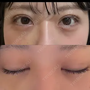 東京シンデレラ美容外科 東京シンデレラ美容外科 池袋院口コミ