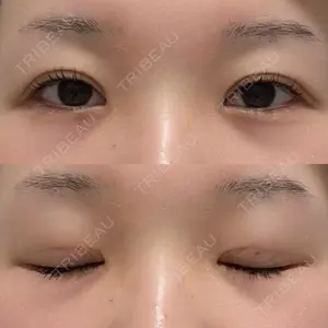 口コミ