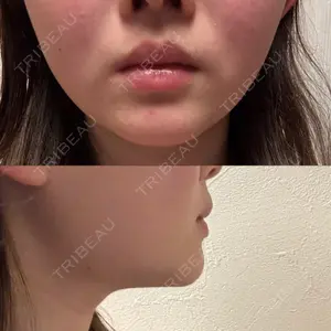 TCB東京中央美容外科 TCB東京中央美容外科 新宿東口院口コミ