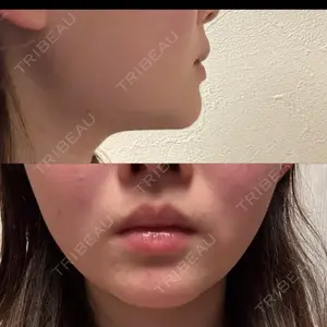 TCB東京中央美容外科 TCB東京中央美容外科 新宿東口院口コミ