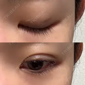 湘南美容クリニック 湘南美容クリニック 新宿本院口コミ