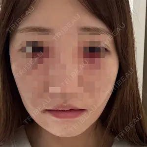 口コミ