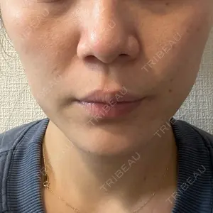 湘南美容クリニック 湘南美容クリニック 博多院口コミ