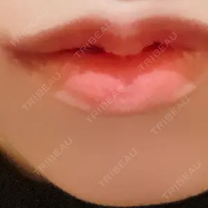 R Beauty CLINIC R Beauty CLINIC 銀座院口コミ