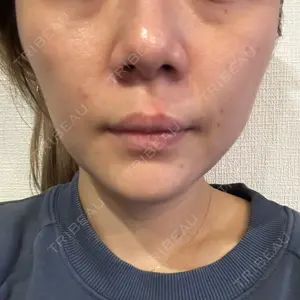 湘南美容クリニック 湘南美容クリニック 博多院口コミ