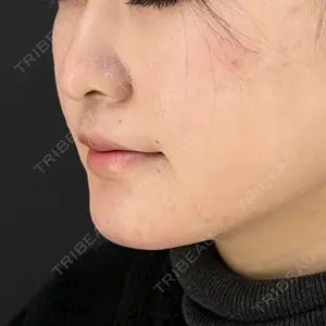 HAAB×DREAM BEAUTY CLINIC HAAB×DREAM BEAUTY CLINIC 東京本院口コミ
