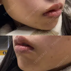 ルラ美容クリニック ルラ美容クリニック 大阪心斎橋院口コミ