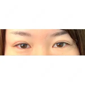 湘南美容クリニック 湘南美容クリニック 千葉センシティ院口コミ