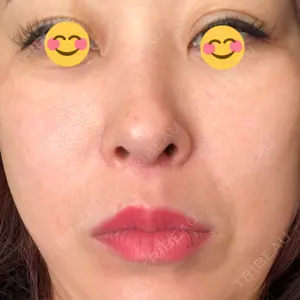 口コミ