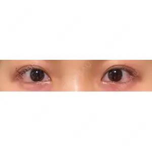 LOUIS CLINIC 二子玉川院【ルイクリニック】口コミ