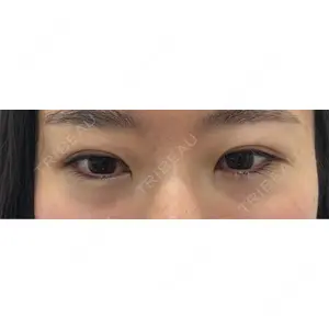 東京シンデレラ美容外科 東京シンデレラ美容外科 池袋院口コミ