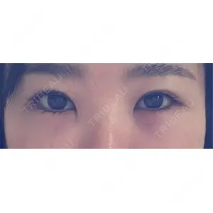 東京シンデレラ美容外科 東京シンデレラ美容外科 池袋院口コミ